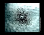gram-positive bacterial colony